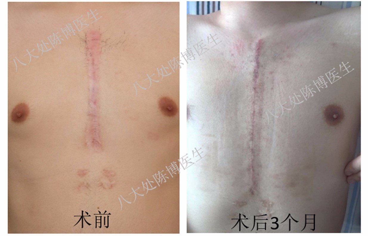 太原疤痕修复加盟修复项目,重塑美丽,自信闪耀 太原疤痕修复加盟修复项目,重塑美丽,自信闪耀