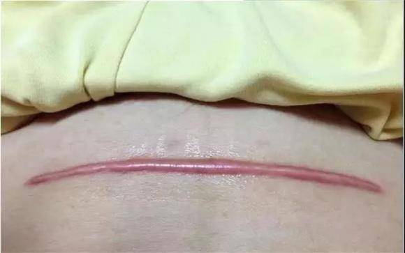 太原疤痕修复加盟修复项目,重塑美丽,自信闪耀 太原疤痕修复加盟修复项目,重塑美丽,自信闪耀