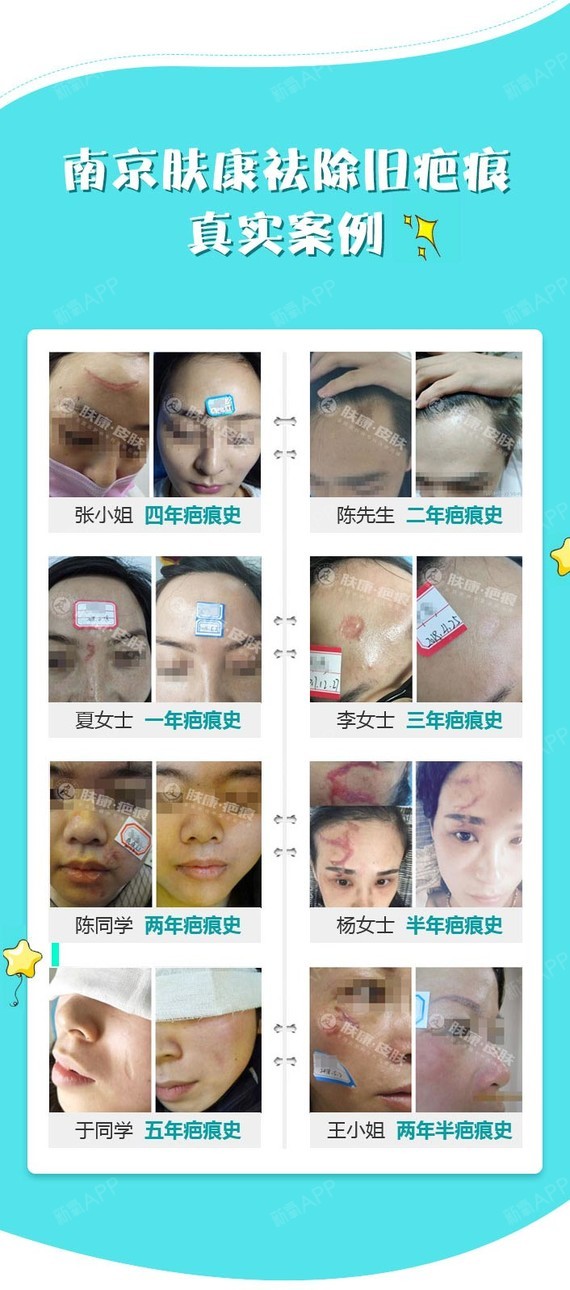昆明祛疤修复加盟项目，美丽事业的崭新篇章