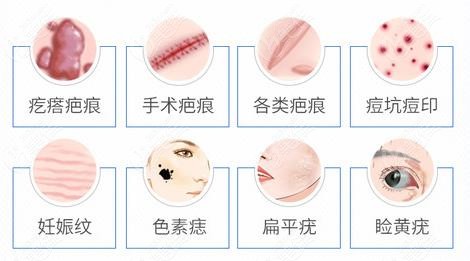 昆明祛疤修复加盟项目，美丽事业的崭新篇章