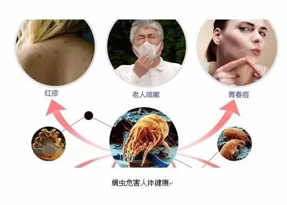 深圳除螨代理加盟品牌大揭秘 深圳除螨代理加盟品牌大揭秘