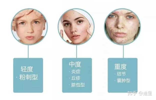 告别红痘印，这些面膜品牌帮你轻松恢复肌肤光彩