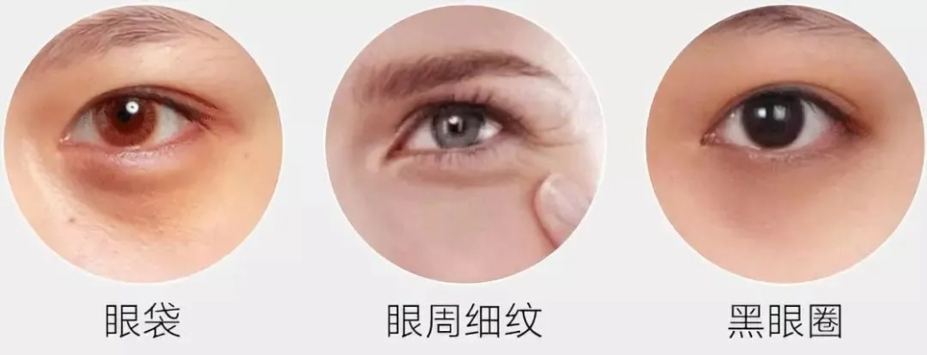 告别眼肿困扰，这些面膜品牌帮你快速消肿！