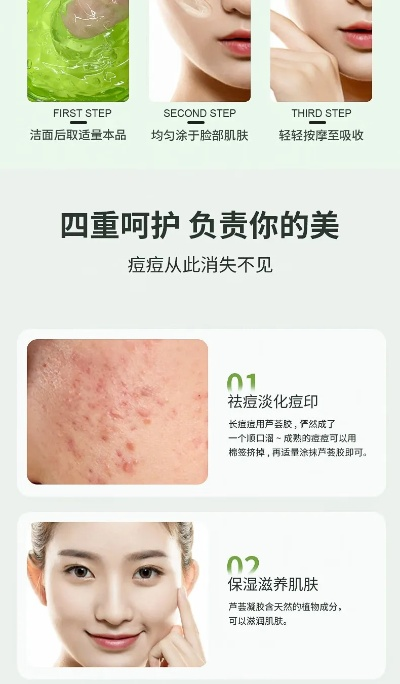 孕妇专用祛痘霜推荐，呵护孕期肌肤，美丽无痕！