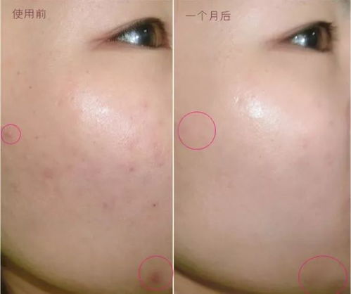泰国海藻面膜品牌大盘点，美丽肌肤的秘密武器！