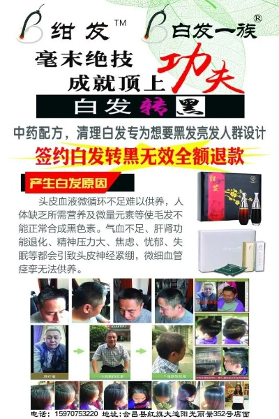 治疗白头发加盟品牌推荐