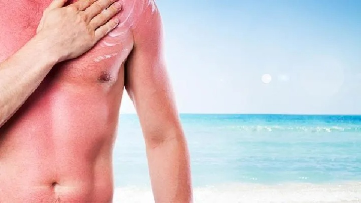 户外防晒，守护肌肤的夏日盾牌