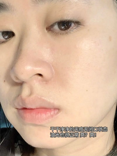 闭口暗黄肌肤的救星—盘点那些口碑爆棚的闭口暗黄面膜品牌