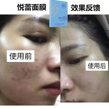 揭秘焕颜面膜界明星品牌，让你的肌肤重焕光彩！