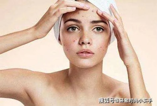 告别红痘疤，这些面膜品牌帮你重拾肌肤光彩