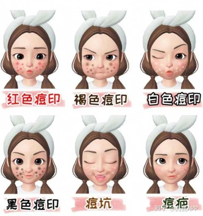 告别红痘疤，这些面膜品牌帮你重拾肌肤光彩