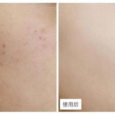 守护宝贝娇嫩肌肤，母婴面霜的选择与智慧