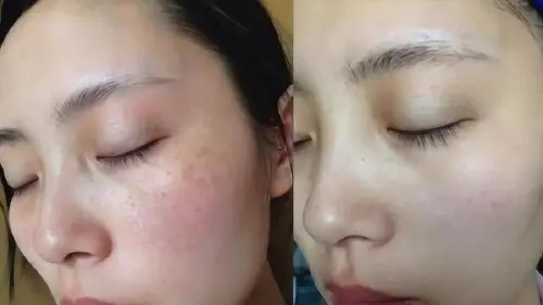 守护肌肤的盾牌，揭秘护肤祛斑神器