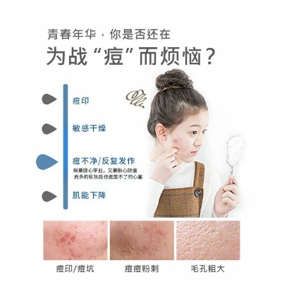 儿童专用祛痘面膜大推荐，温和护肤，告别青春痘烦恼