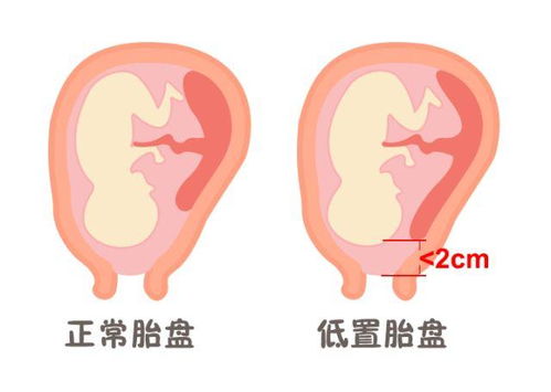 母婴大头品牌深度解析