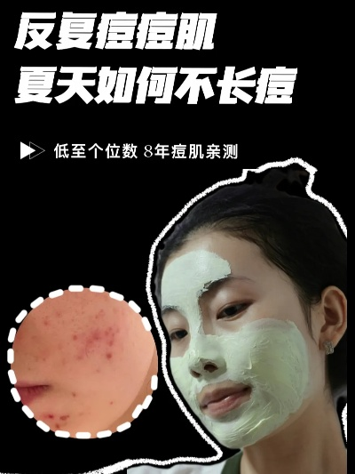 夏天痘肌面膜红黑榜，油痘肌必看避雷+平价贵妇推荐全攻略