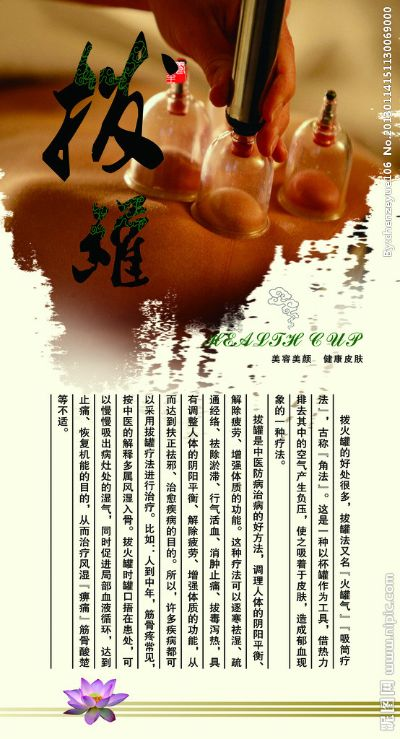 拔罐店加盟品牌推荐，探寻热门加盟品牌