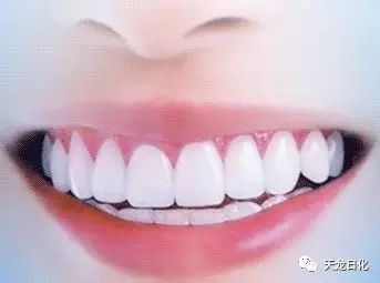 昆明正畸患者的零食天堂，这些品牌让牙齿整齐又美味！