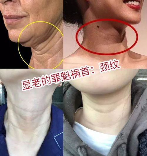 平价瘦颈纹面膜推荐指南，百元内也能拥有天鹅颈！