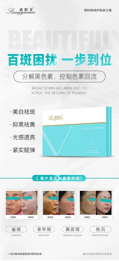 邵阳祛斑品牌招商加盟大盘点