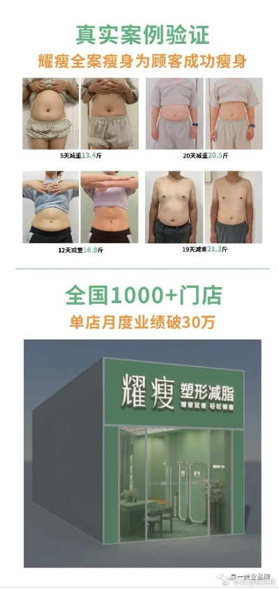 郑州减肥塑形加盟品牌推荐及案例分析