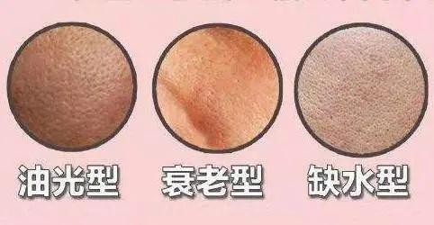 油皮亲妈面膜红榜，这8款让你告别油光，毛孔会呼吸！