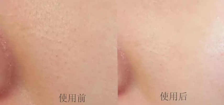 油皮亲妈面膜红榜，这8款让你告别油光，毛孔会呼吸！