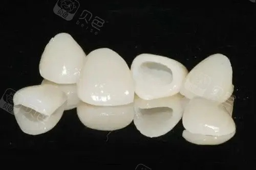 日本陶瓷牙品牌全解析，技术、选择与真实案例