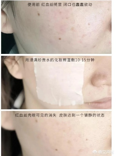 急救吸黑头+淡斑面膜红黑榜，这8款让我素颜敢怼脸拍！学生党到贵妇都看这篇