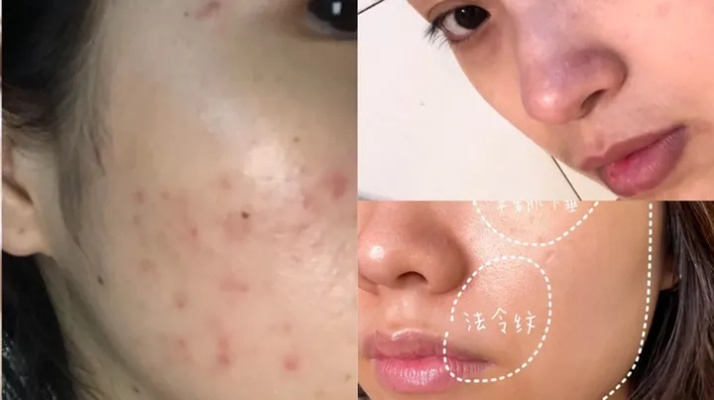 急救吸黑头+淡斑面膜红黑榜，这8款让我素颜敢怼脸拍！学生党到贵妇都看这篇