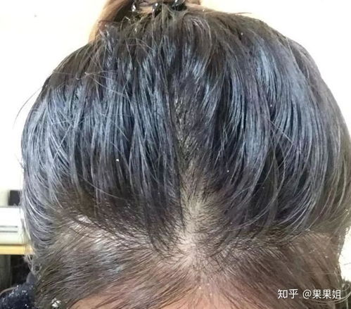好用的打磨陶瓷头发品牌 好用的打磨陶瓷头发品牌