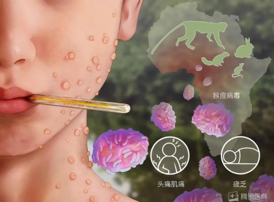 猴痘高发期必看！这5大面膜品牌如何帮你科学防护？附使用指南和真实案例