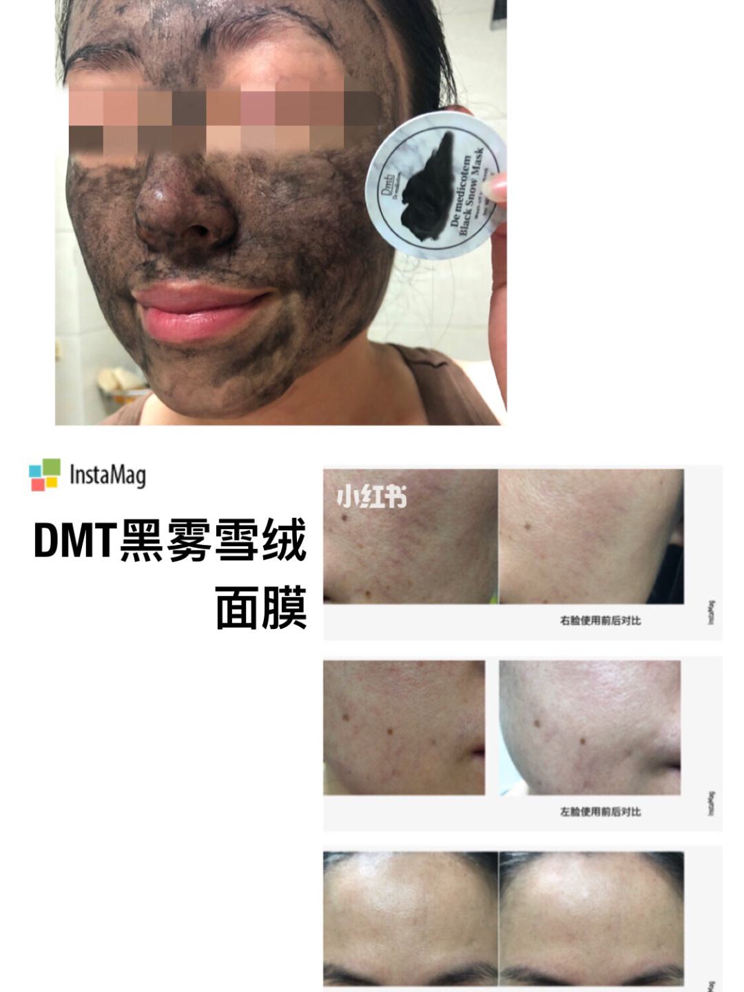 dmt面膜 韩国dmt面膜