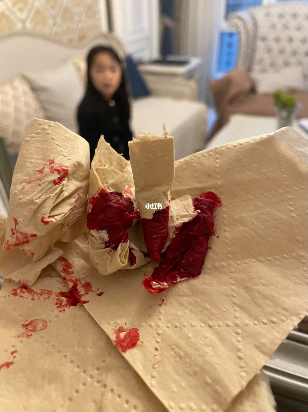 吃火锅流鼻血 吃火锅流鼻血正常吗