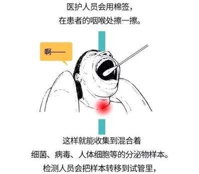 新冠病毒标本采集的步骤 新冠病毒标本采集的注意事项