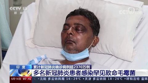 新冠病毒黑木耳真菌 新冠病毒突变体黑木耳