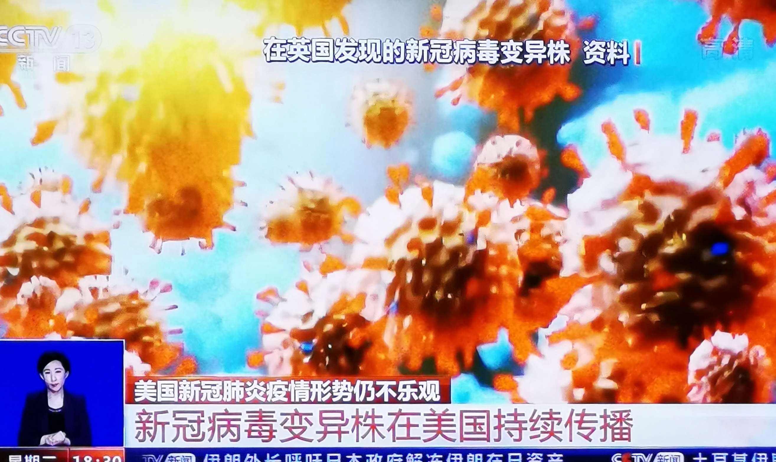 新冠病毒肺炎实录视频 新型冠状病毒肺炎的视频