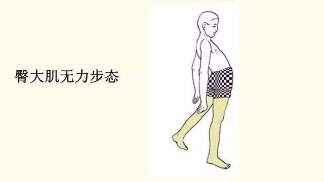 膝盖不好怎么减肥 膝盖不好怎么减肥小红书