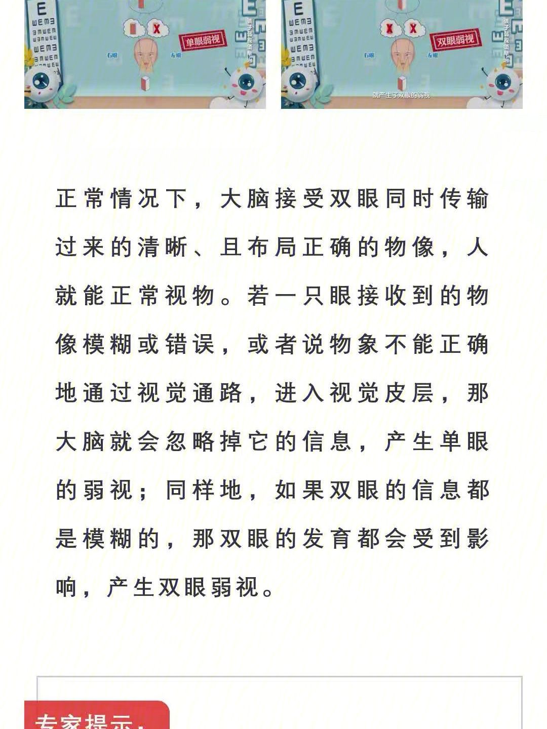 一只眼弱视能考驾照吗 一只眼睛弱视可以考驾照吗?