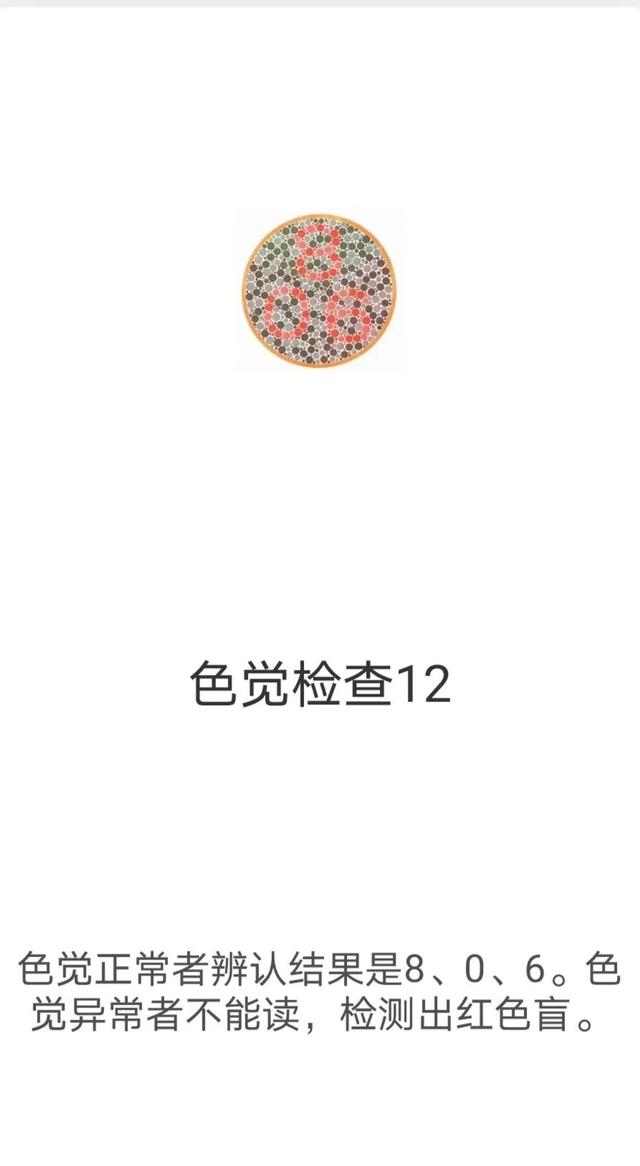 考驾照体检项目有哪些多少钱 考驾照体检项目有哪些多少钱啊