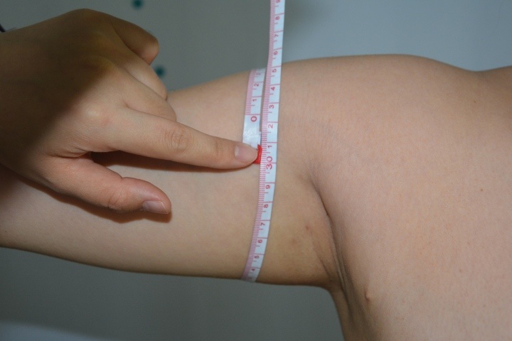 腿部吸脂减肥术价格 大腿吸脂减肥价格多少钱
