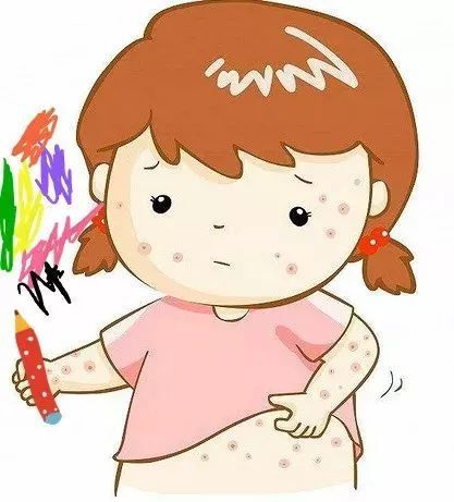 对美术颜料过敏的症状 人体彩绘颜料过敏怎么办