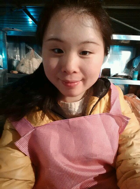 怀孕为什么鼻子变大 怀孕为什么鼻子变大变红
