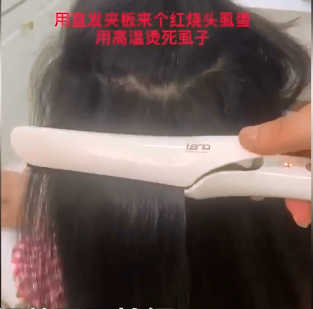 白酒可以杀死头虱吗 白酒可以杀死头虱子吗