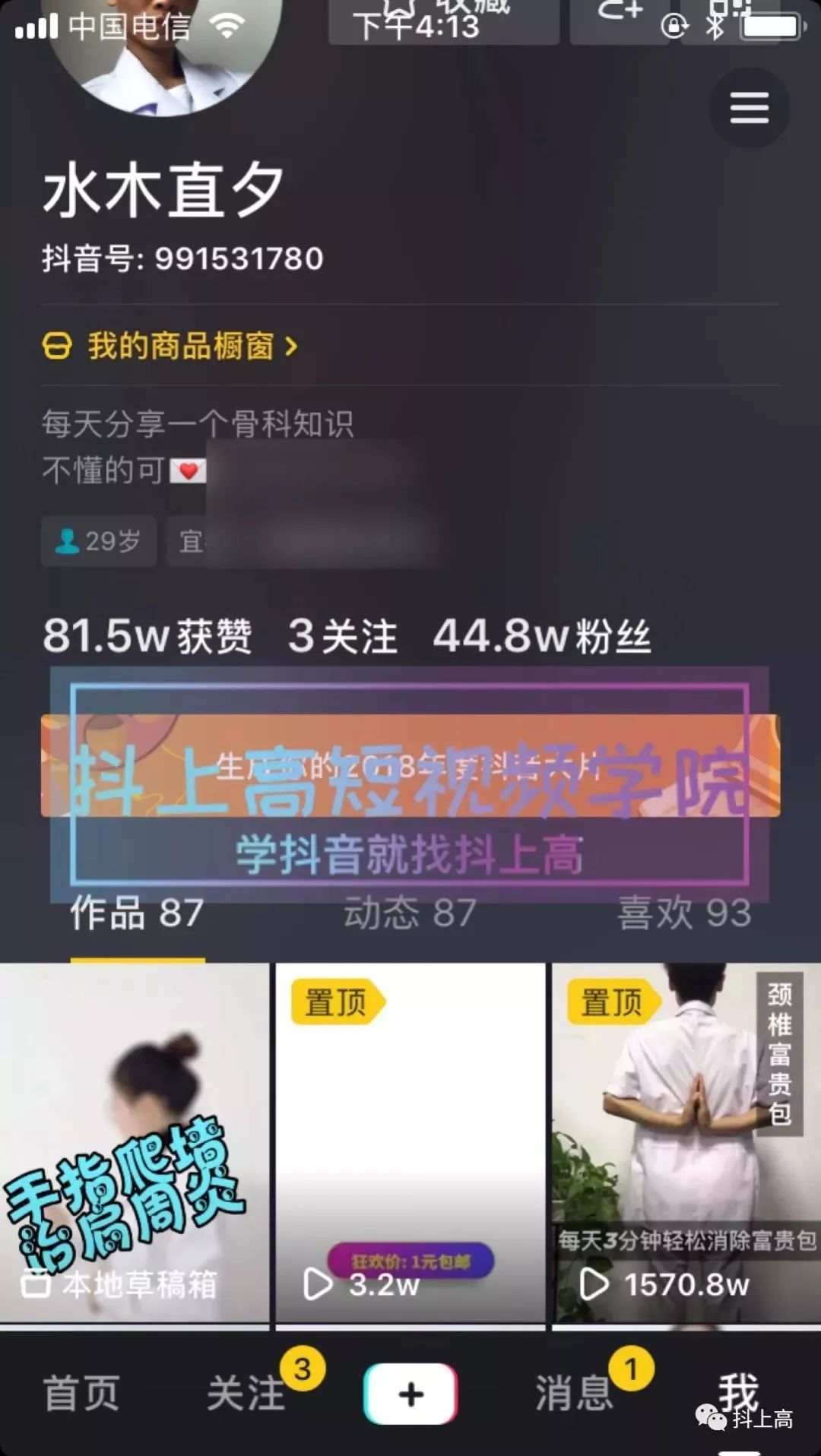 抖音发广告一个粉丝多少钱 抖音广告进粉平均多少钱一个