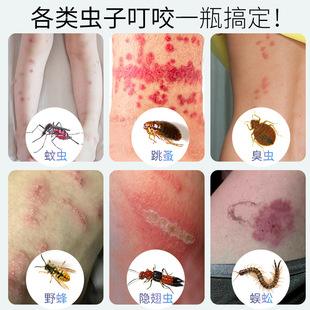 除螨仪推荐除跳蚤 除螨仪器可以除跳蚤吗 除螨仪推荐除跳蚤 除螨仪器可以除跳蚤吗