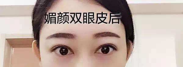 三层眼皮运势(眼皮三层的命理)